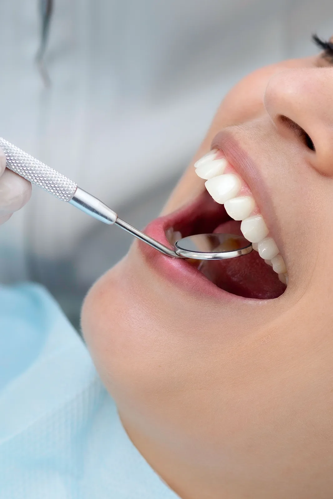 Checking restoration margins with a dental mirror, referred to in the Implant Cost section for Toronto