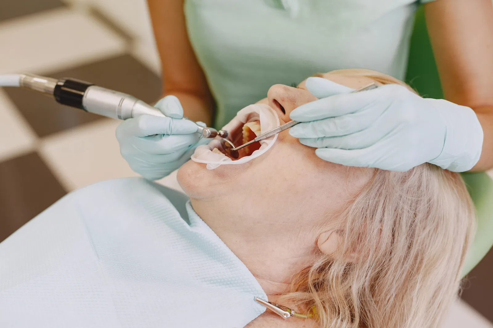 Tooth prepared for a crown with a dental handpiece, shown while covering Implant Lifespan in Toronto