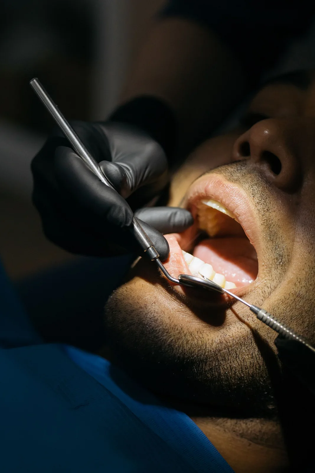 Close-up of a dental examination, referred to in the Dental Implants section for Toronto