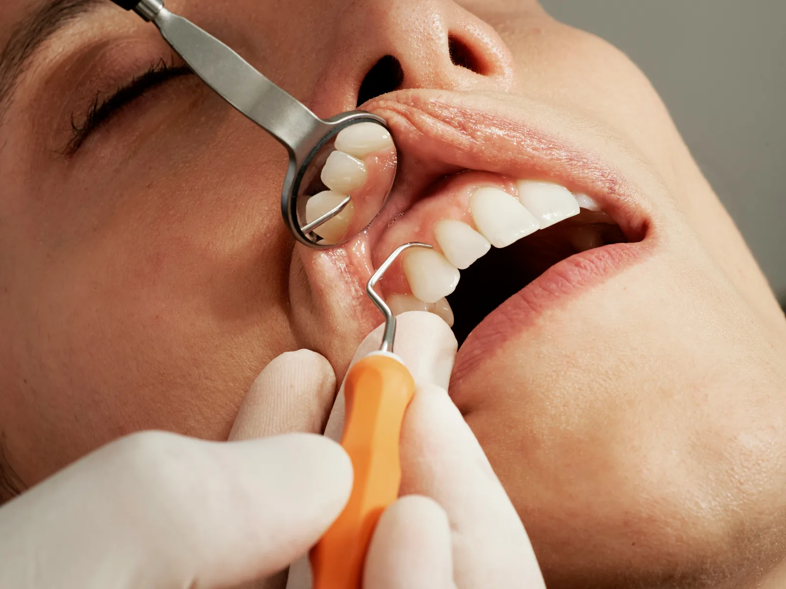 Dental examination with mirror and probe at a consultation in Toronto