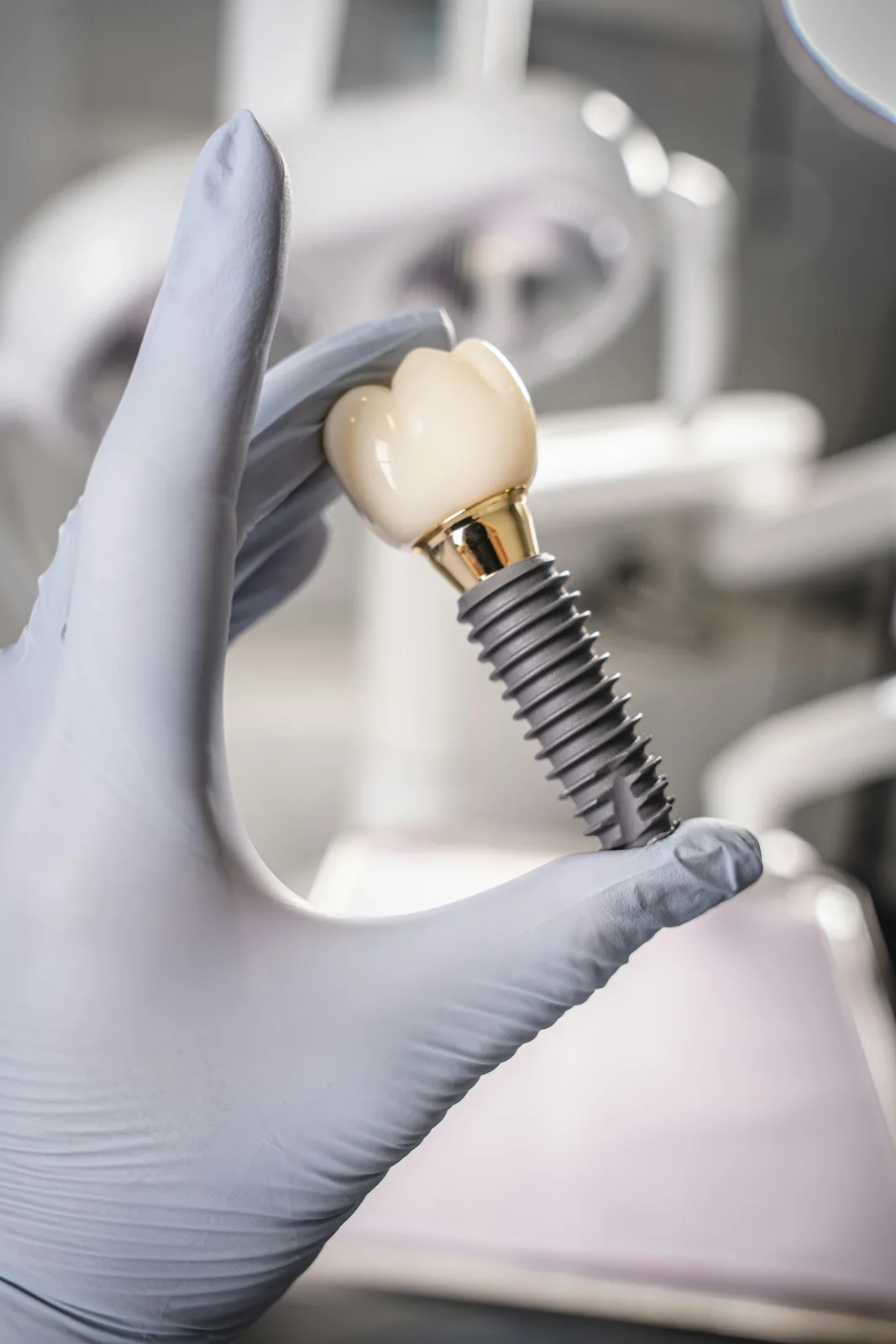 Dental implant fixture, abutment and crown, referred to in the dental implant treatment section for Toronto