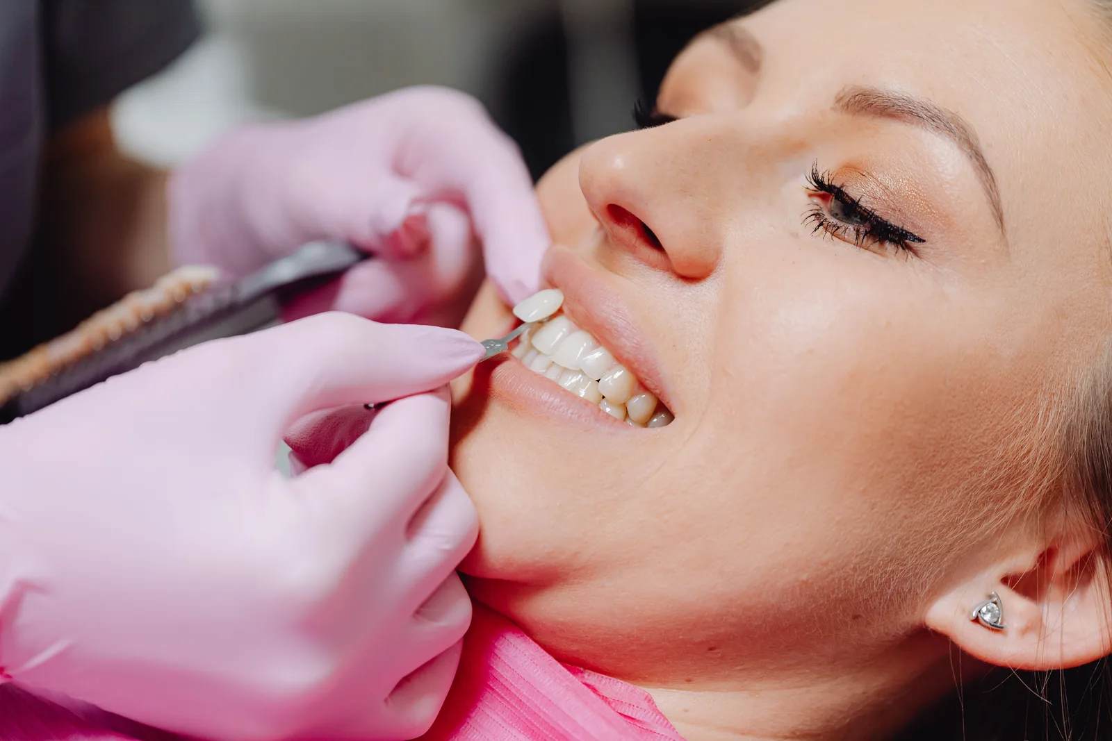 Checking gum health around the teeth, alongside the Tooth Extraction Implant explanation in Toronto