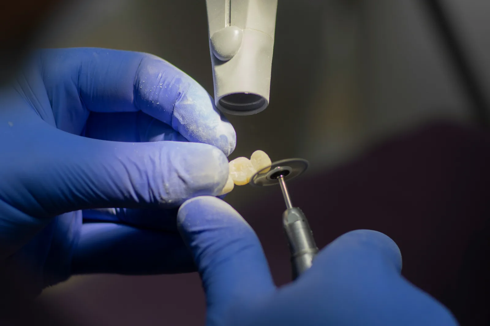 Technician finishing an implant crown in the laboratory, for multiple tooth implants in Toronto