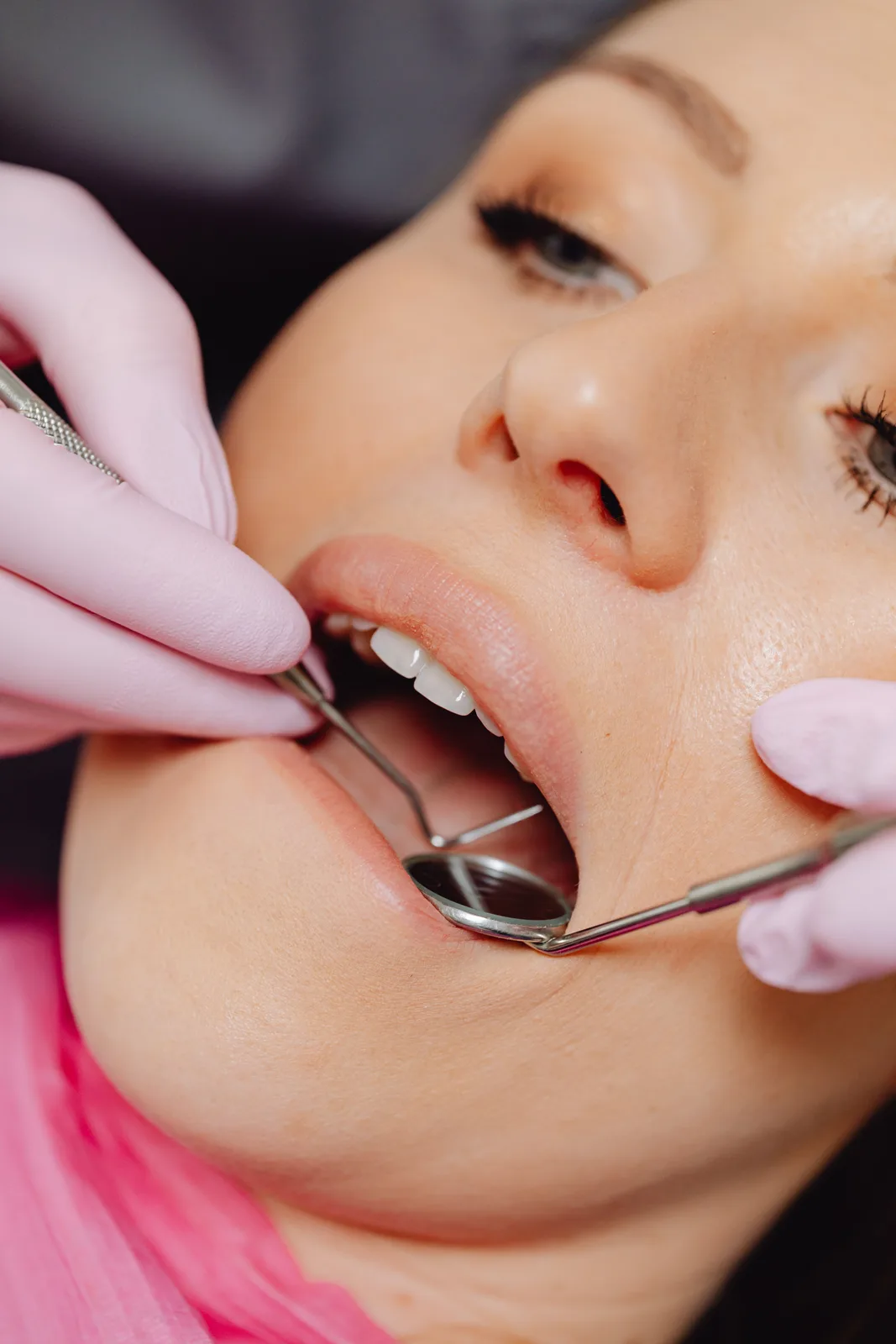 Mirror and probe exam of the lower arch, referred to in the Tooth Extraction Implant section for Toronto