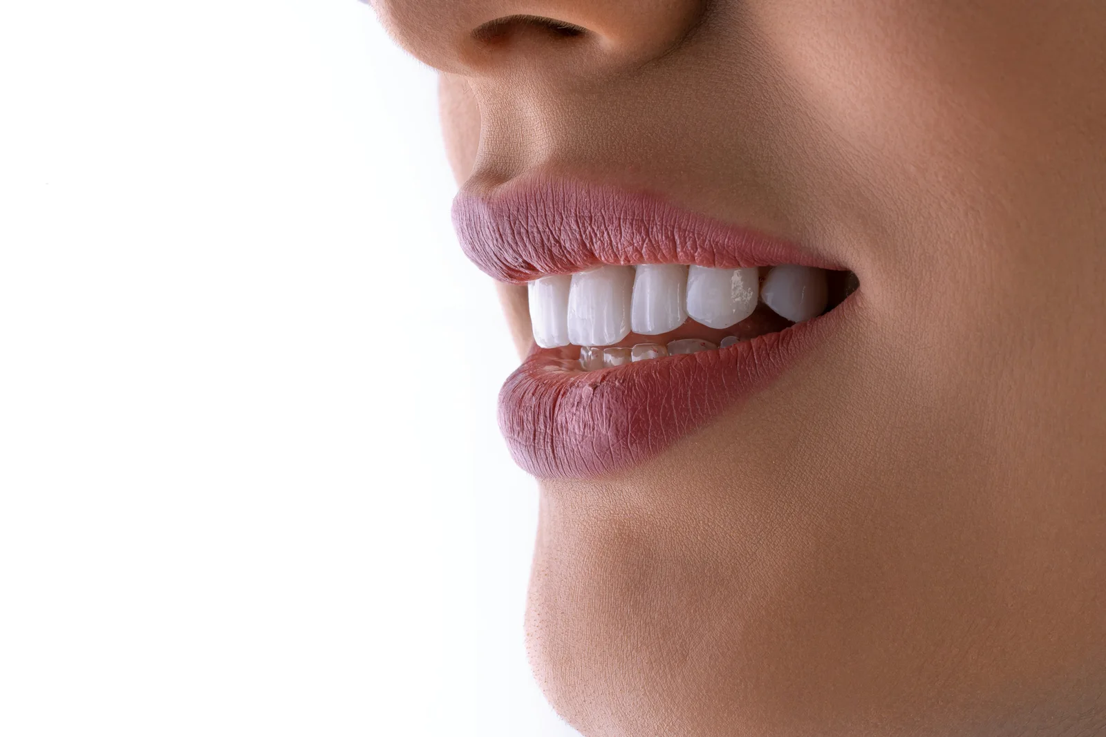Patient profile smile after implant restoration, referred to in the Same Day Implants section for Toronto