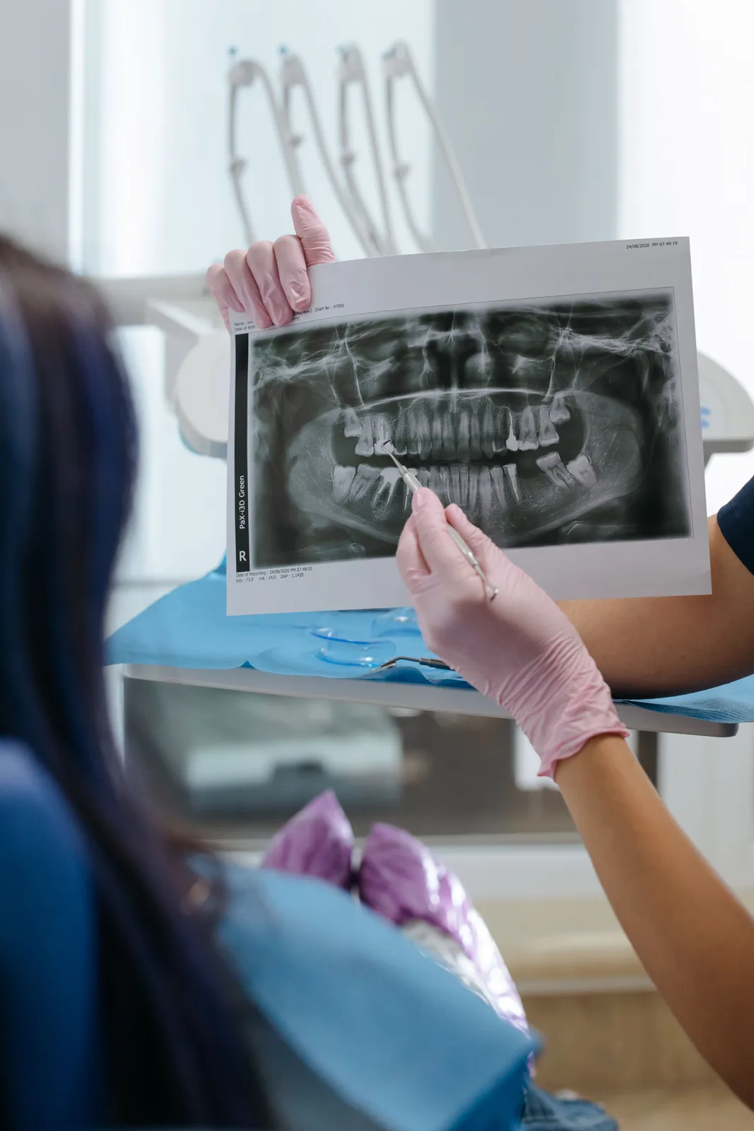 Reviewing a panoramic X-ray with a patient, alongside the Socket Preservation explanation in Toronto