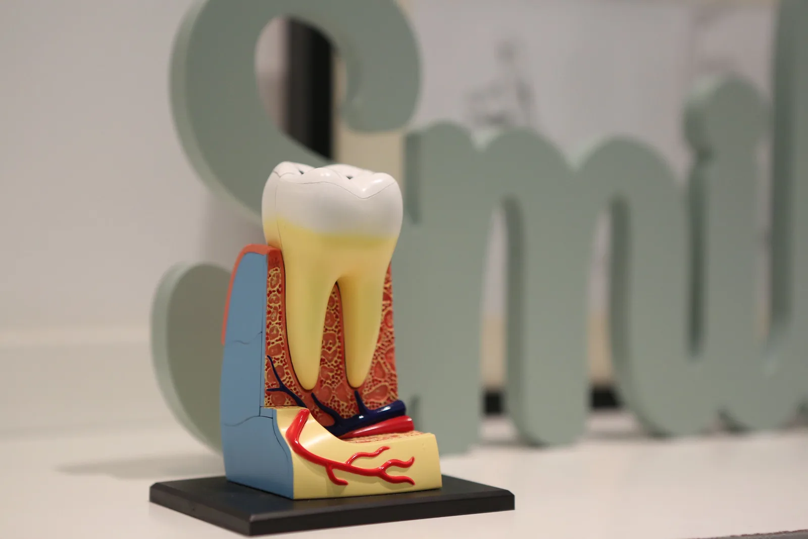 Tooth anatomy model showing the root below the gum, shown while covering Implant Cost in Toronto