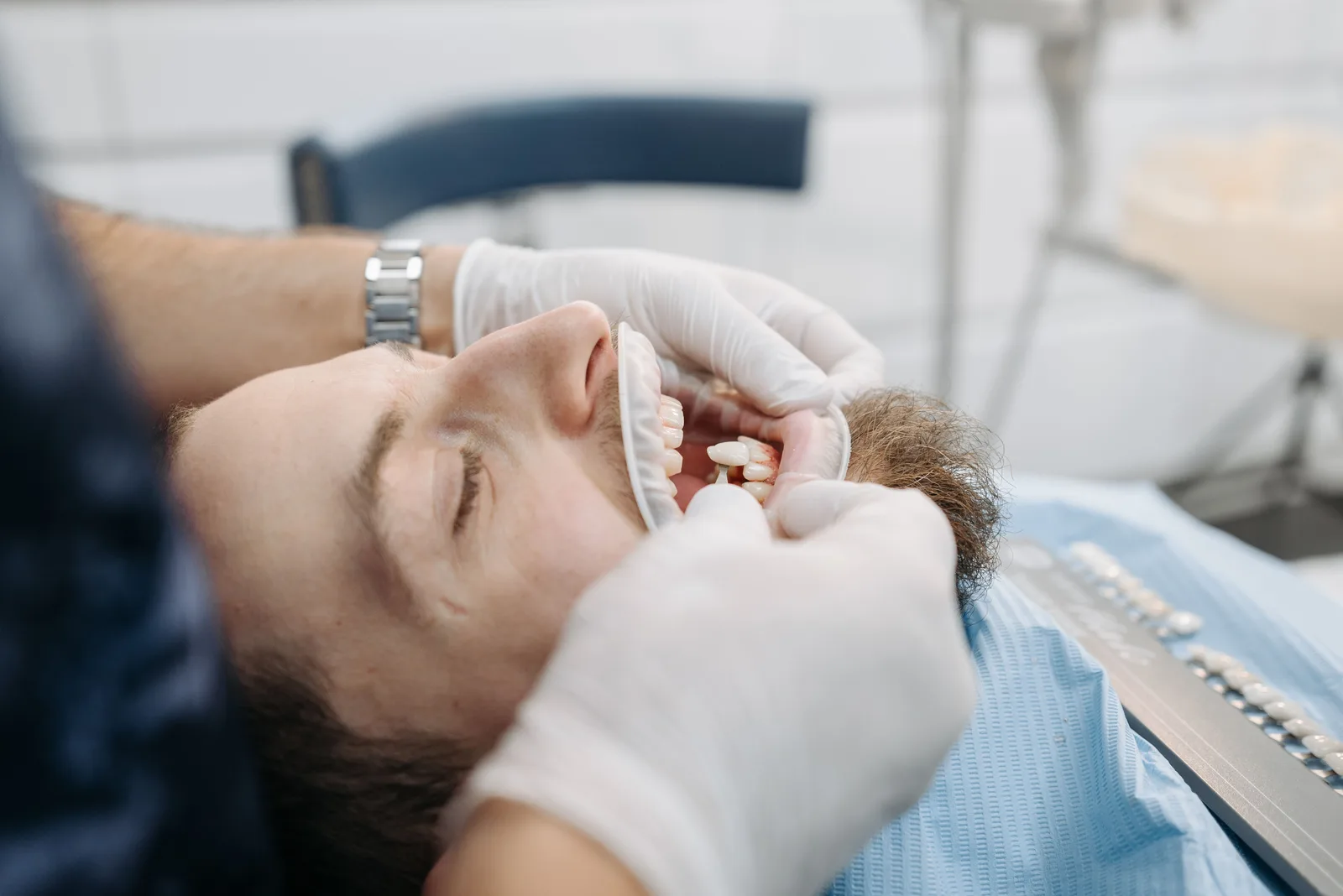 Trying in the shade for an implant crown, alongside the All-on-6 Implants explanation in Toronto