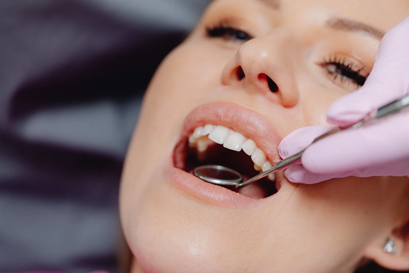 Upper arch exam with mirror and probe, shown while covering Implants In Mississauga in Toronto